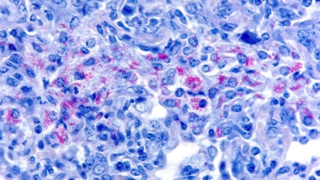 Institut Pasteur - La tuberculose - Brigitte Gicquel