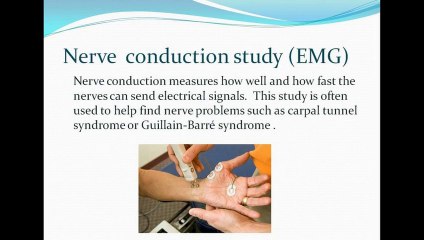 Nerve  conduction study (EMG)
