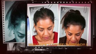 tips for hair growth - tips for healthy hair - trichologist - Dr. Ari Arumugam - Hari Loss Treatment Chennai - Dr. Ari Chennai