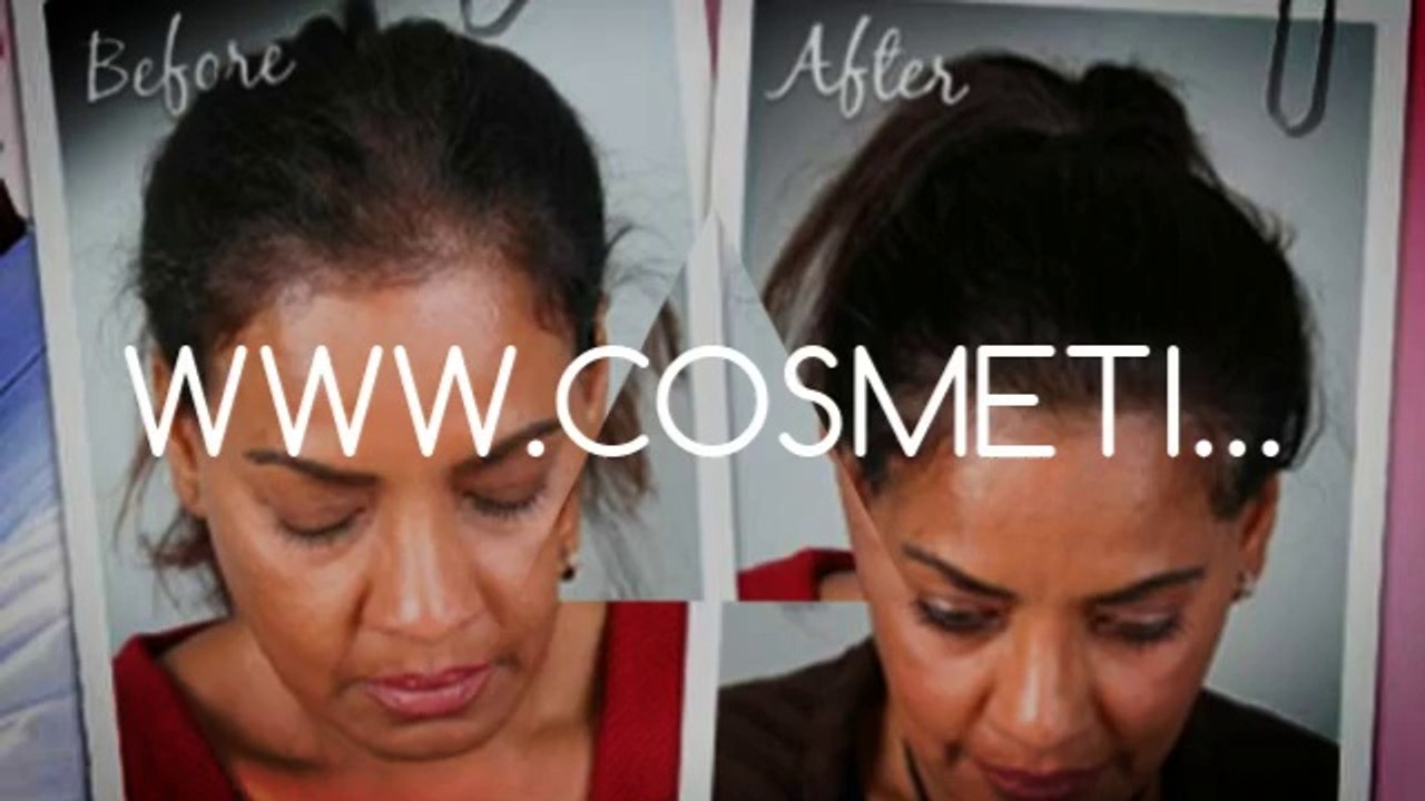 trichologist - vitamins for hair - vitamins for hair growth - Dr. Ari Chennai - Dr. Ari Arumugam - Cosmetic Surgery Chennai