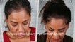 home remedies for hair growth - how to grow hair - how to reduce hair fall - Dr. Ari Arumugam - Cosmetic Surgery Chennai - Dr. Ari Chennai