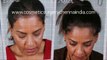 scalp med - shampoo for hair loss - thinning hair - Hari Loss Treatment Chennai - Dr. Ari Chennai - Dr. Ari Arumugam