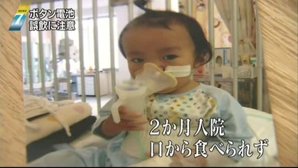 14 06 18 AK NN7　ボタン電池　誤飲　潰瘍