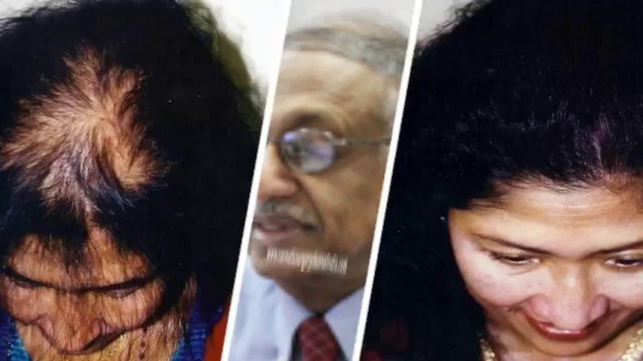 hair spa - hair thinning - hair transplant - Hari Loss Treatment Chennai - Dr. Ari Chennai - Dr. Ari Arumugam