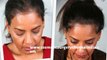 hair thinning - hair transplant - hair treatment - Hari Transplant Chennai - Dr. Ari Chennai - Dr. Ari Arumugam
