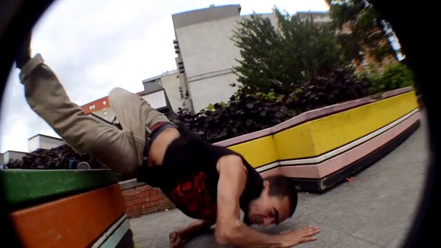 Bosse géante sur le front après une grosse gamelle en skate!