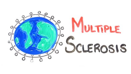 Multiple Sclerosis