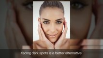 Use An Age Spot Remover For More Fair Radiant Skin