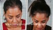 how to stop hair fall - how to stop hair loss - laser comb - Plastic Surgery Chennai - Dr. Ari Chennai - Dr. Ari Arumugam