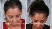 how to stop hair fall - how to stop hair loss - laser comb - hair Transplant Chennai - Dr. Ari Chennai - Dr. Ari Arumugam