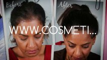 How To Use Onion Juice For Hair Regrowth Hair Loss Grey Hair