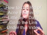 How to Get Rid of Acne Fast - Get Rid of Acne in as Little as 7 Days