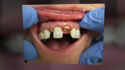 Cosmetic Dentist Frisco TX  972-335-7666
