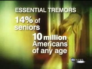 Musician Plays Violin During Brain Surgery