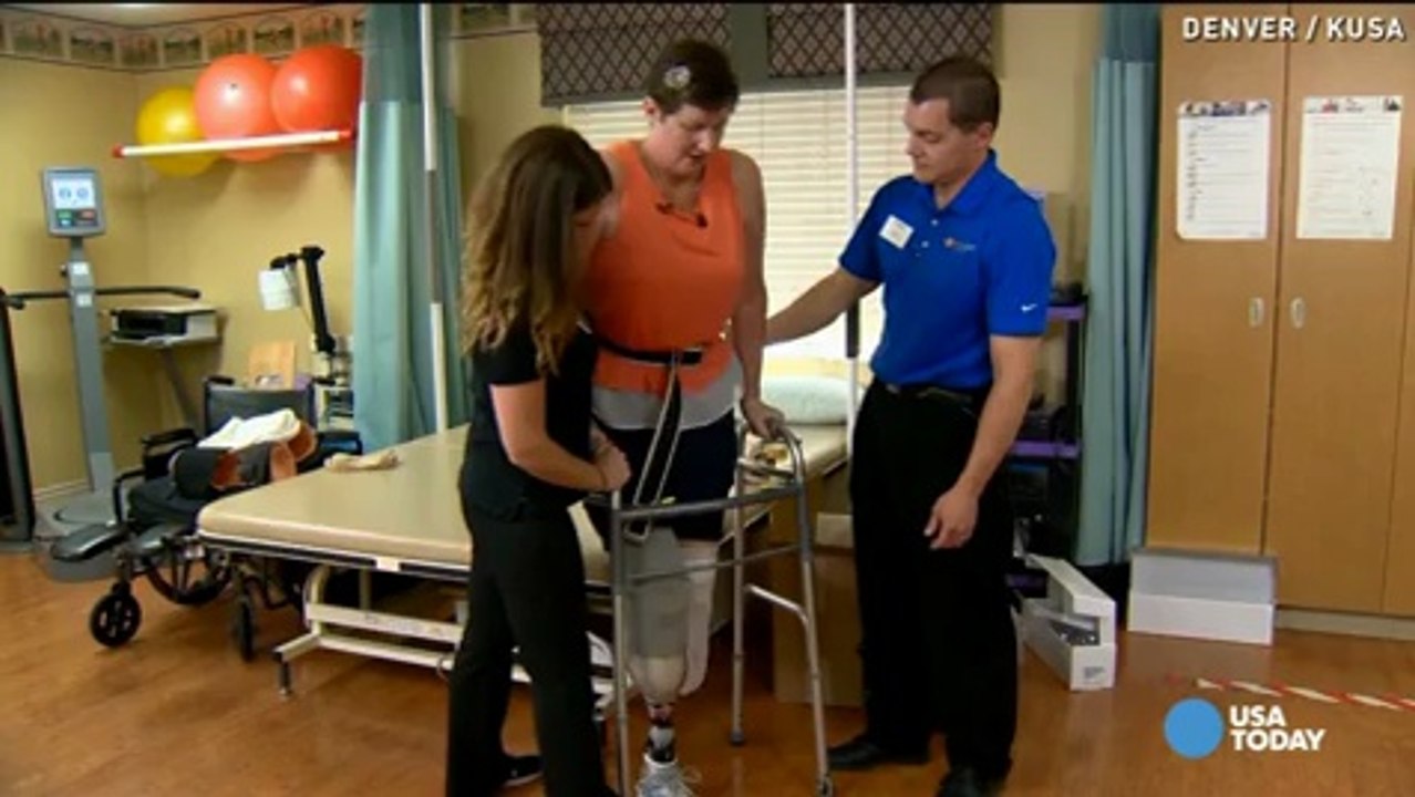 Double amputee welcomes new legs, plans to walk again