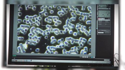 TRULY HEAL brain cancer