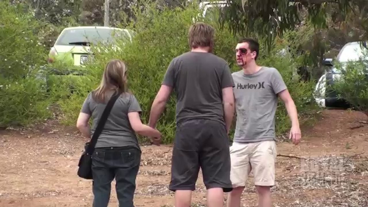 Missing Eye SCARE PRANK