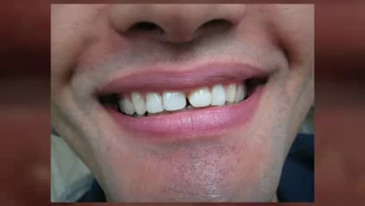 Cosmetic Dentist Frisco TX  972-335-7666