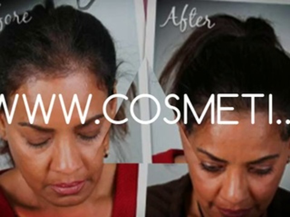 thinning hair women - tips for hair growth - tips for healthy hair - Plastic Surgery Chennai - Dr. Ari Chennai - Dr. Ari Arumugam