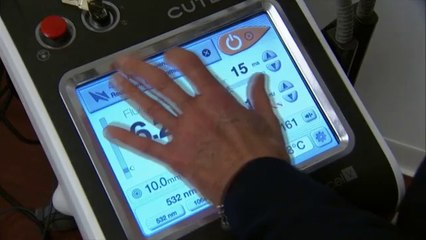 Cutera Excel V  Brandt 1