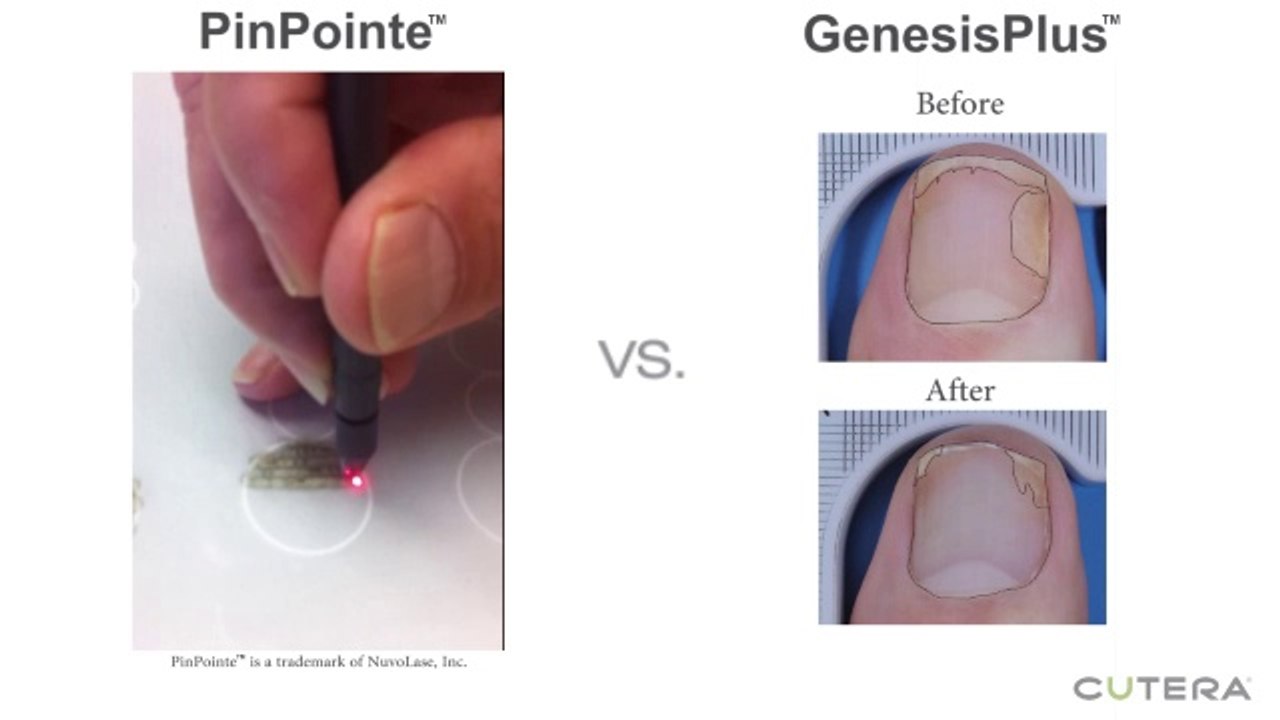 GenesisPlus  vs Pinpointe