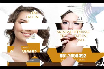 Skin Whitening Treatment in Pakistan | Skin Whitening Treatment in Islamabad | Skin Whitening Treatment in Lahore