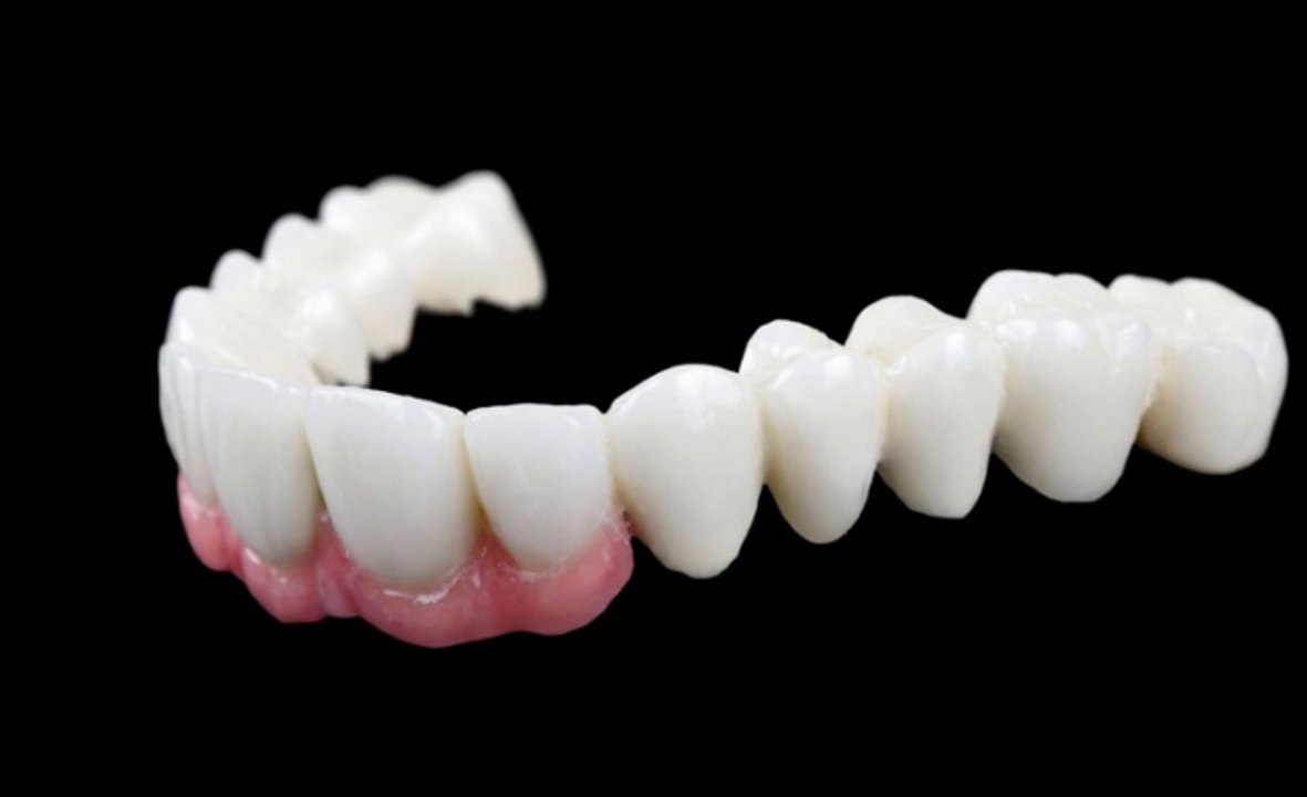 Considering An Rockville MD Dental Implants?