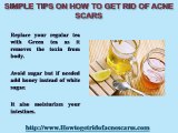 Simple Tips On How To Get Rid Of Acne Scars