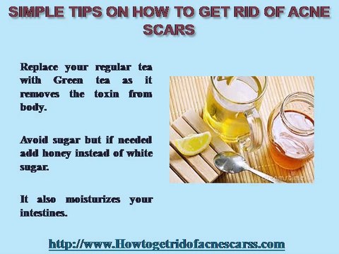 Simple Tips On How To Get Rid Of Acne Scars