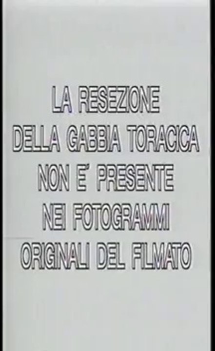 UFO Dossier X - 05 - Autopsie di alieni (parte 1)