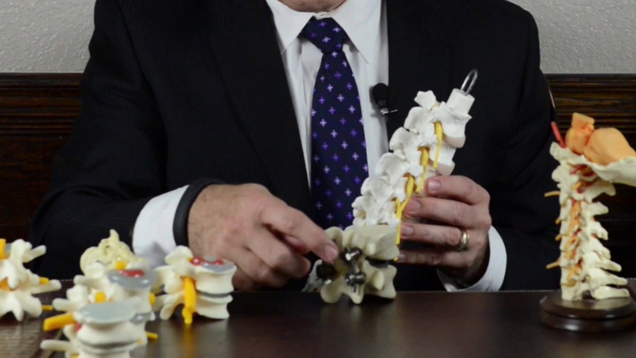 Lumbar Spine & Low Back Part 3