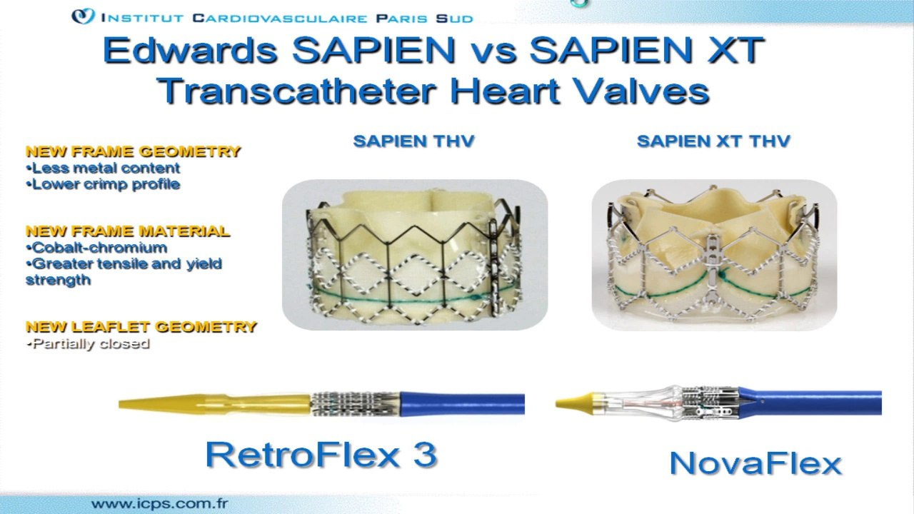 Expérience avec la valve. Dr. Edwards Sapien