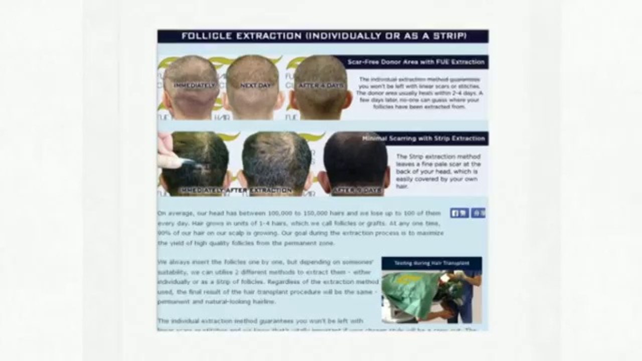 Fue Hair Transplants