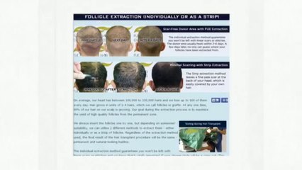 Fue Hair Transplants