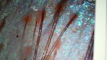 Women Hair Loss Treatments Diagnosis