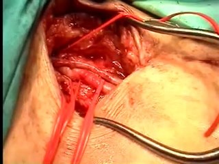 ---SİGARANIN GERÇEK YÜZÜ BELGESELİ (21 Dakika) - YouTube