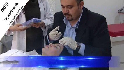DR ONUR GURBUZ BOTOX UYGULAMASI