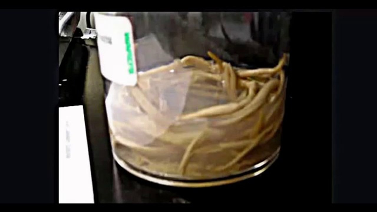 Round Worm Life Cycle Made Easy To Learn