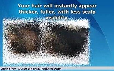 Hair Building Fiber In Pakistan