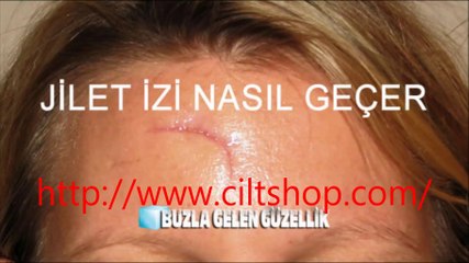 Cilt Lekesi Tedavisi