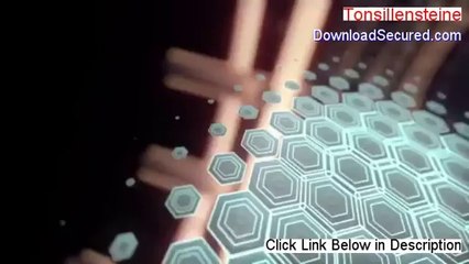 Tonsillensteine PDF Download (tonsillensteine hausmittel)