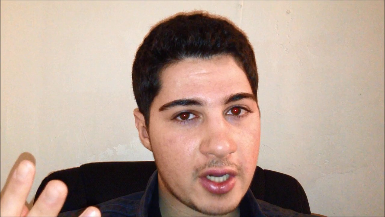 Acne Scars - Saline injections + Other Treatments