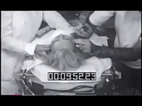 1942 YILINDA YAPILAN BİR LOBOTOMY BEYİNİ İKİYE YARMA AMELİYATI!