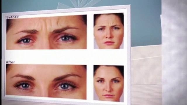 Dermal Fillers In Milton Keynes