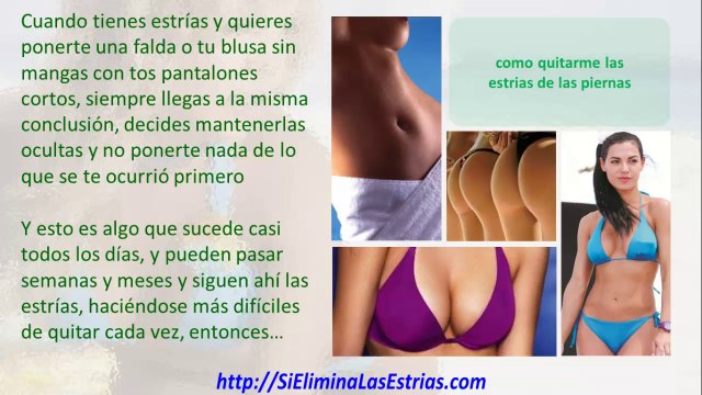 como quitarme las estrias