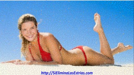 como curar las estrias