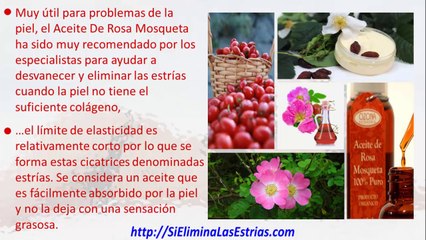 aceite de rosa mosqueta estrias