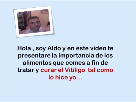 Alimentos Para Curar El Vitiligo - se puede prevenir el vitiligo