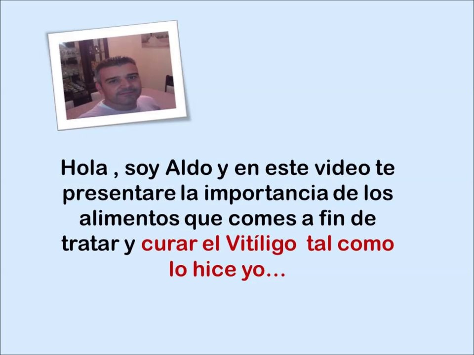 Alimentos Para Curar El Vitiligo - se puede prevenir el vitiligo