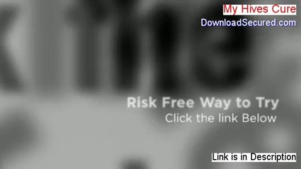 My Hives Cure Free PDF (Get It Now 2014)